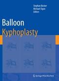 Balloon Kyphoplasty