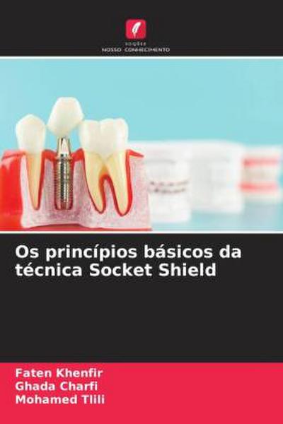 Os princípios básicos da técnica Socket Shield