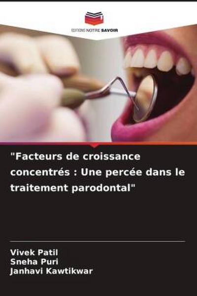 "Facteurs de croissance concentrés : Une percée dans le traitement parodontal"
