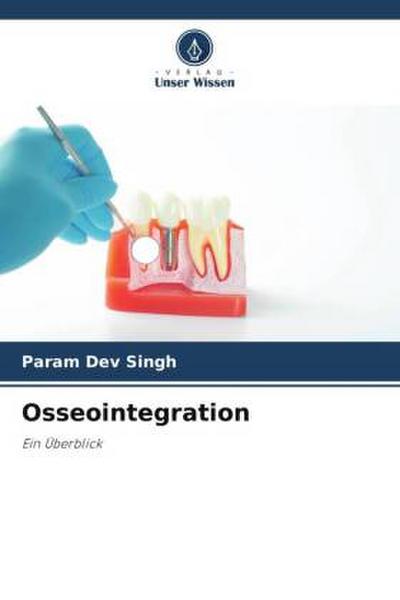 Osseointegration