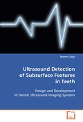 Ultrasound Detection of Subsurface Features in Teeth
