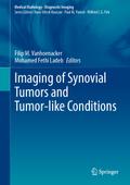 Imaging of Synovial Tumors and Tumor-like Conditio