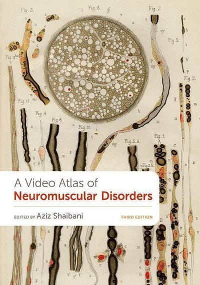 A Video Atlas of Neuromuscular Disorders