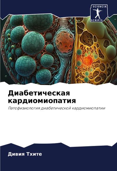 Diabeticheskaq kardiomiopatiq