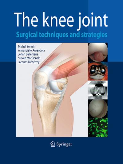 The Knee Joint