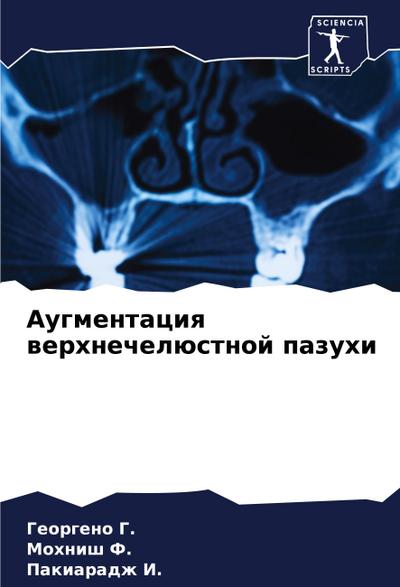 Augmentaciq werhnechelüstnoj pazuhi