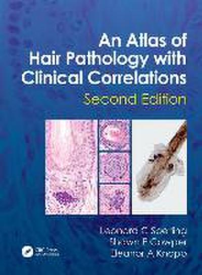 An Atlas of Hair Pathology with Clinical Correlations