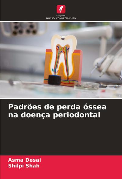 Padrões de perda óssea na doença periodontal