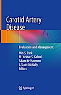Carotid Artery Disease