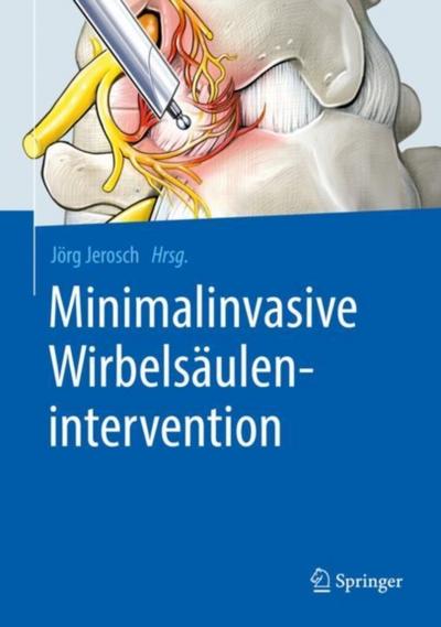 Minimalinvasive Wirbelsäulenintervention