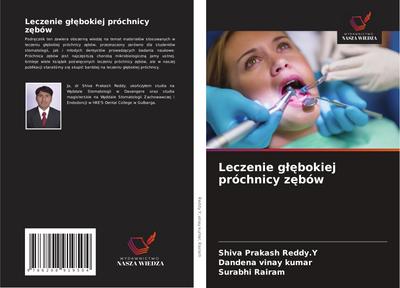 Leczenie g¿¿bokiej próchnicy z¿bów