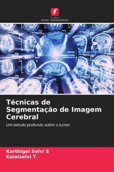 Técnicas de Segmentação de Imagem Cerebral