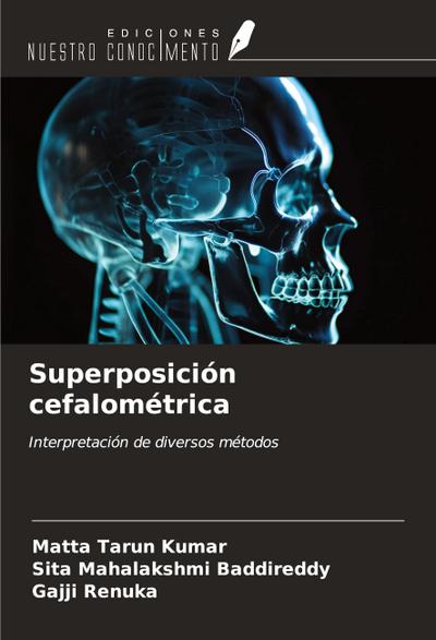 Superposición cefalométrica