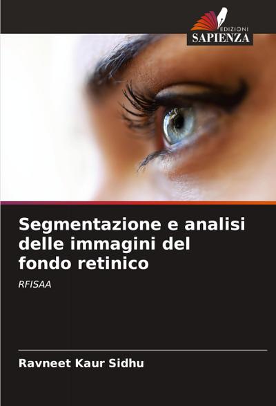 Segmentazione e analisi delle immagini del fondo retinico
