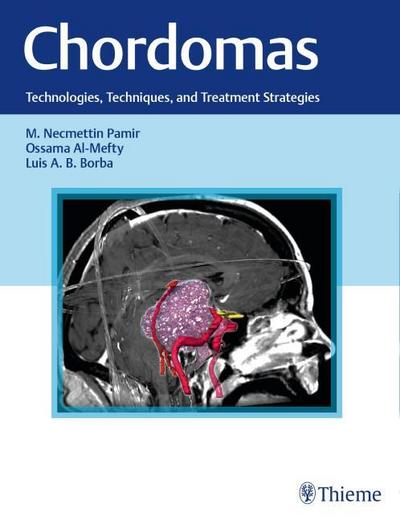 Chordomas