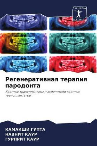 Regeneratiwnaq terapiq parodonta