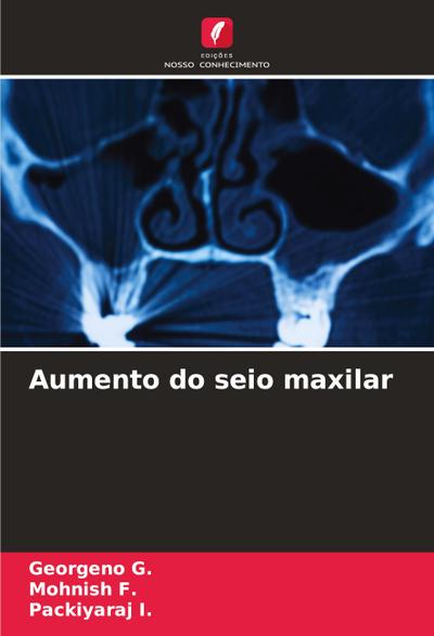 Aumento do seio maxilar