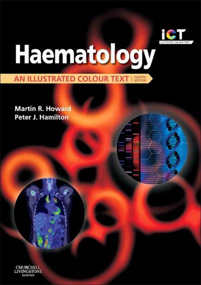 Haematology E-Book