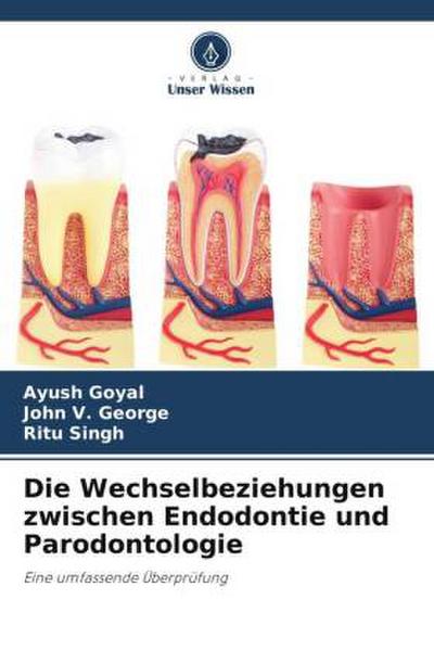 Die Wechselbeziehungen zwischen Endodontie und Parodontologie