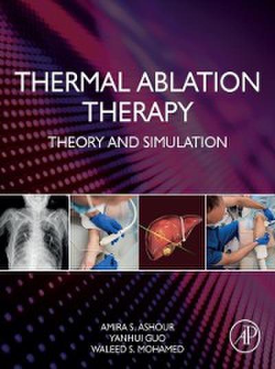 Thermal Ablation Therapy