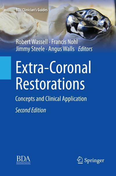 Extra-Coronal Restorations