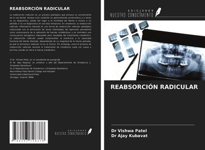 REABSORCIÓN RADICULAR