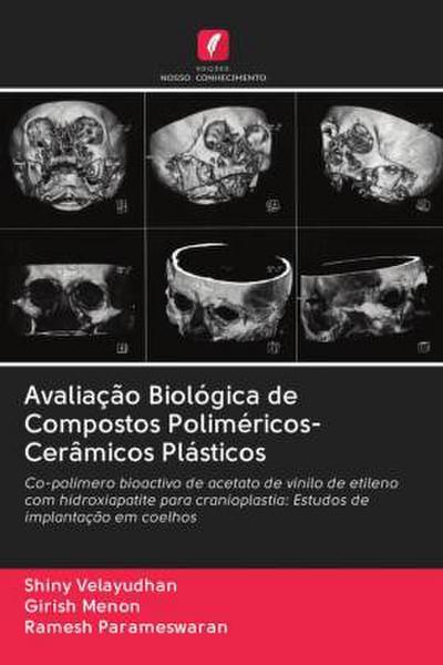 Avaliação Biológica de Compostos Poliméricos-Cerâmicos Plásticos