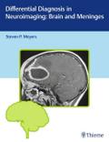 Differential Diagnosis in Neuroimaging: Brain and 