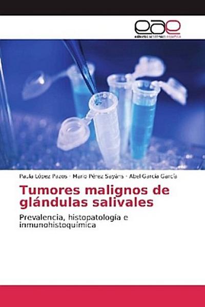 Tumores malignos de glándulas salivales