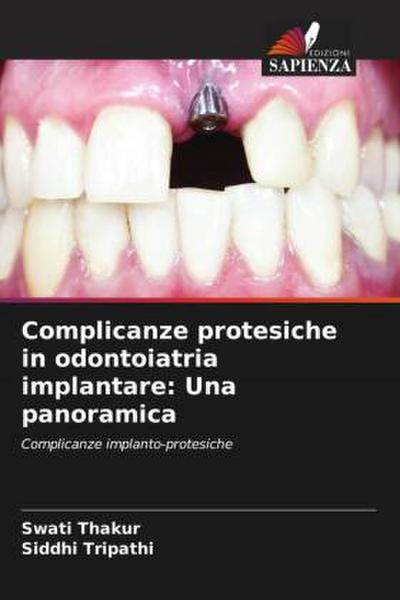 Complicanze protesiche in odontoiatria implantare: Una panoramica