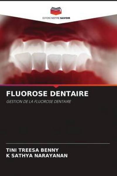 FLUOROSE DENTAIRE