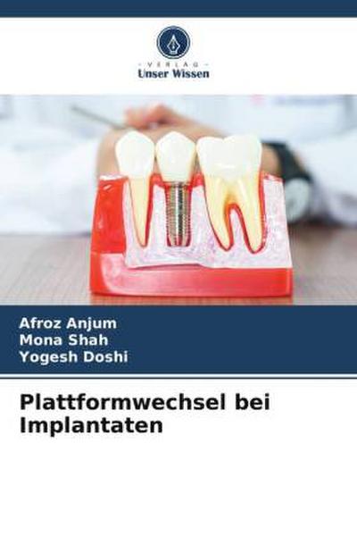 Plattformwechsel bei Implantaten