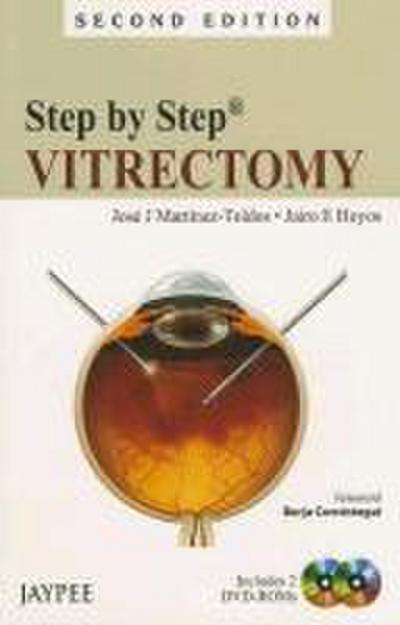 Step by Step
