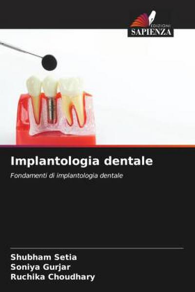 Implantologia dentale