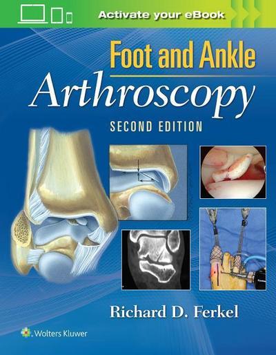 Ferkel, R: Foot & Ankle Arthroscopy