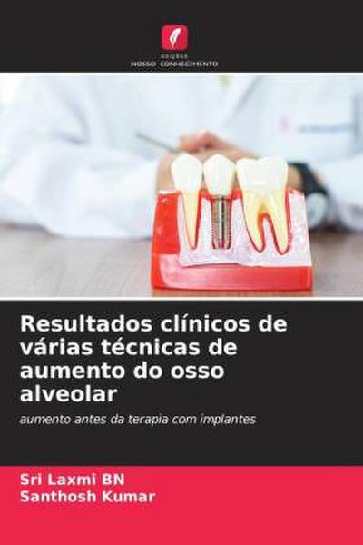 Resultados clínicos de várias técnicas de aumento do osso alveolar