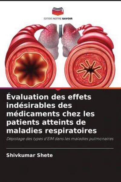 Évaluation des effets indésirables des médicaments chez les patients atteints de maladies respiratoires