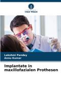Implantate in maxillofazialen Prothesen