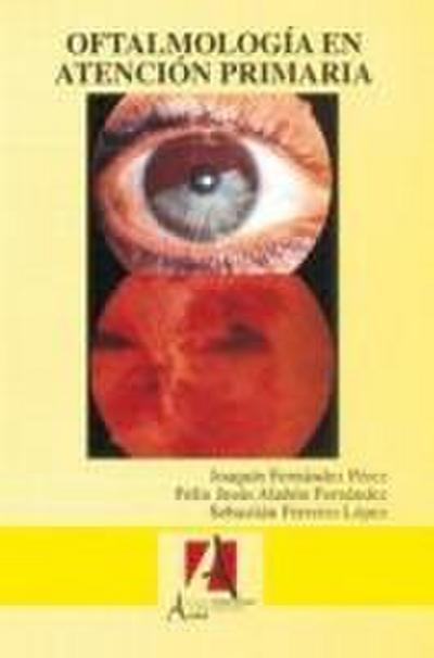 Oftalmología en atención primaria