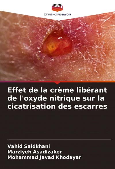 Effet de la crème libérant de l’oxyde nitrique sur la cicatrisation des escarres