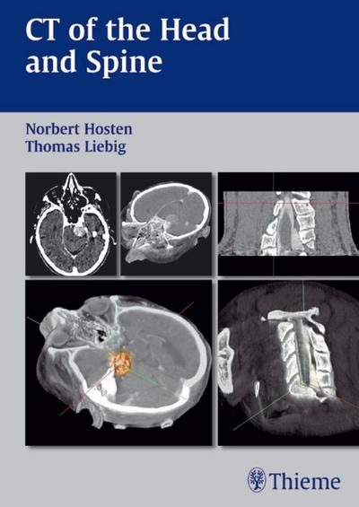 CT of the Head and Spine