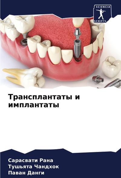 Transplantaty i implantaty