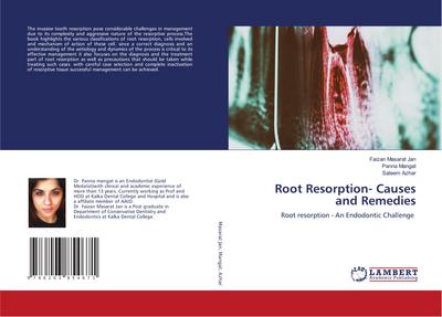 Root Resorption- Causes and Remedies
