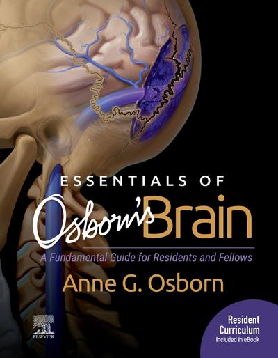 Essentials of Osborn’s Brain E-Book