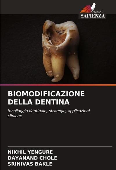 BIOMODIFICAZIONE DELLA DENTINA