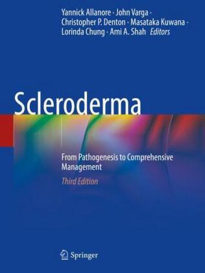 Scleroderma