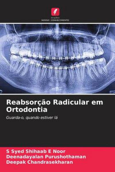 Reabsorção Radicular em Ortodontia
