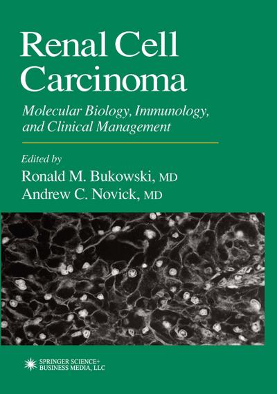 Renal Cell Carcinoma
