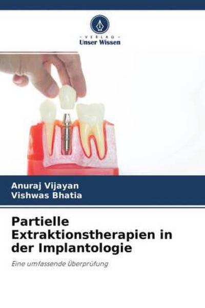 Partielle Extraktionstherapien in der Implantologie