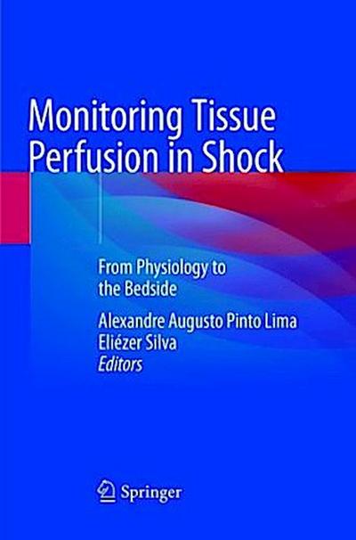 Monitoring Tissue Perfusion in Shock